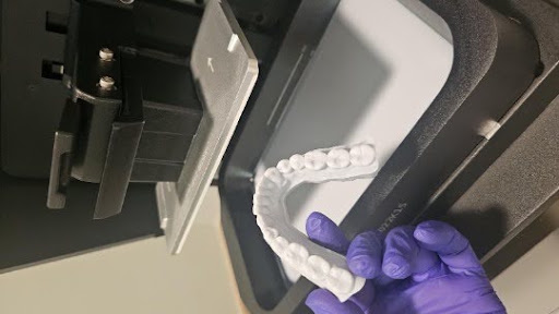 3D printed dental models and appliances