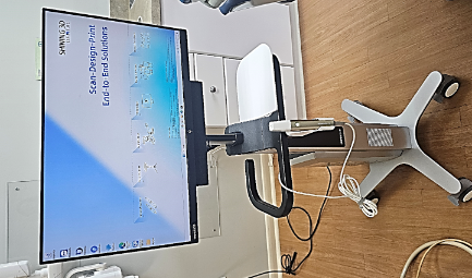 Digital intraoral scan of teeth on screen